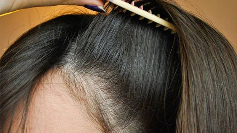 طريقة عمل شامبو طبيعي لتكثيف الشعر