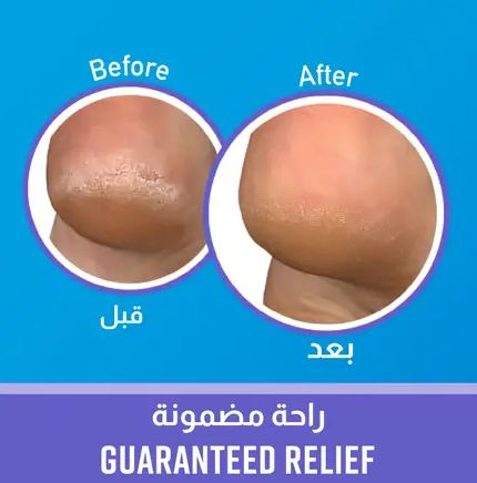 تجربتي مع كريم اوكيفيز هيلثي فيت كريم الليلي
